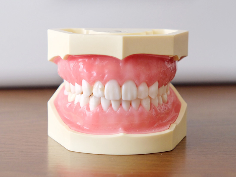 入れ歯・義歯のご相談にも対応
